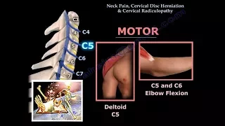 Neck Pain, Cervical Disc Herniation & Radiculopathy-Everything You Need To Know - Dr. Nabil Ebraheim