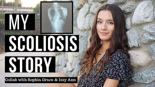 my scoliosis story | jessica