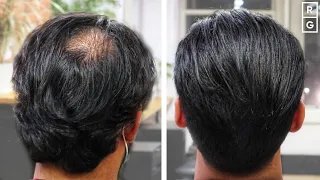 Great Haircut For Thinning Hair At The Back *NO ENHANCEMENTS*