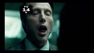 HANNIBAL GETS HIS MOUTH SWABBED