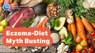 Eczema-Diet Myth Busting