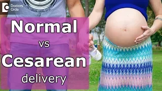 Normal delivery vs cesarean delivery: Which is better? - Dr. Bhupinder Singh Duggal of Cloudnine