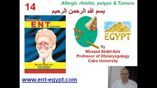 Nose 4 (Mosaad Abdel-Aziz): Allergic rhinitis, Nasal polyps, Nasal tumors and Cysts