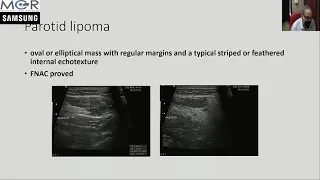 SALIVARY GLAND ULTRASOUND