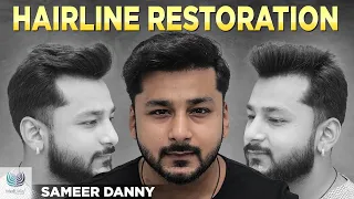Sameer Danny (@workoutwala7822 ) Hair Transplant Results | Best Hair Transplant Results | Medlinks