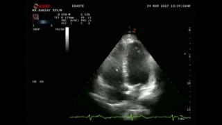 A  complete echo study Dr Rakesh Gupta