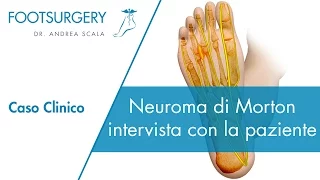 Neuroma di Morton intervento: intervista con la paziente | Neuroma di Morton prima e dopo