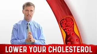 How to Control Cholesterol With Very Simple Hacks – Dr.Berg