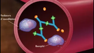 immune complex type iii hypersensitivity