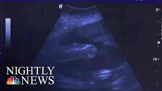 Louisiana Expected To Become Latest State To Ban Fetal Heartbeat Abortion | NBC Nightly News