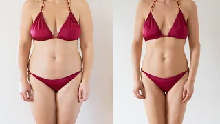 Liposuction (Yağ Alma) Ameliyatı, Öncesi ve Sonrası Süreç