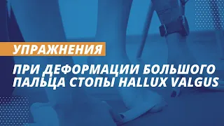 Упражнения и тейпирование при деформации большого пальца стопы Hallux Valgus