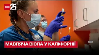 🦠 У Каліфорнії впровадили надзвичайний стан через мавпячу віспу – ТСН