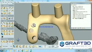 Designing Sub-Periosteal Implant | How to Design Implant using Geomagic Freeform with Haptic Device