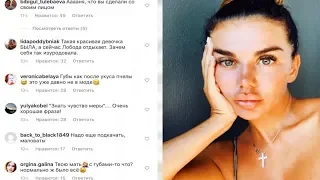 Седокова пытается вновь привлечь Малахова, но переколотое лицо Анны отпугивает даже фанатов