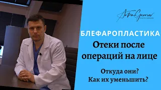 Отеки после операций на лице | Откуда они? | Как избавиться от отеков