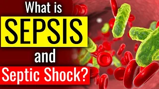 What is SEPSIS and SEPTIC SHOCK ? The Body's Deadly response to Infection. Sepsis - Cause. Symptom.