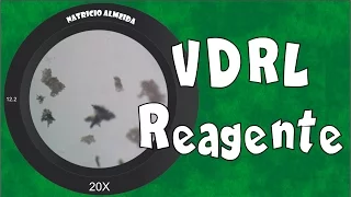 Teste de VDRL Reagente | Visto ao microscópio