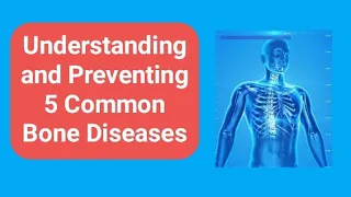 Understanding and Preventing 5 Common Bone Diseases