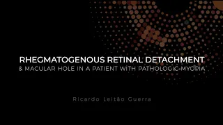 RHEGMATOGENOUS RETINAL DETACHMENT AND PATHOLOGICAL MYOPIA