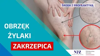 Zakrzepica często atakuje żyły w podudziach🦵| w 50% jest bezobjawowa | Środa z Profilaktyką