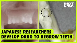 Japanese researchers develop drug to regrow teeth | NEXT NOW