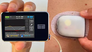 Omnipod 5 vs Tandem t:slim x2 | Full Test & Review