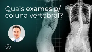 Quais exames são feitos para a coluna vertebral?