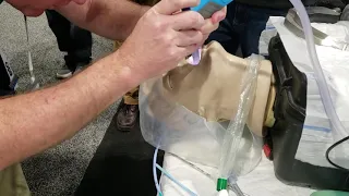 SALAD Intubation on a Manikin With the Vie Scope®