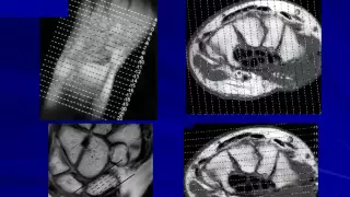 Imaging of Wrist joint   Prof Dr  Salwa Fathy In Arabic 720p