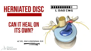 Can A Herniated Disc Heal?  WITHOUT surgery?!? 2023