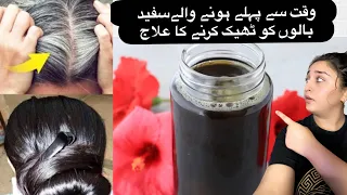 Grey Hair | Turn white Hair To Black | Sfaid Bal Kaly Krny Ka Tarika @sehrimishi4226