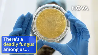 This Fungus Is Spreading Rapidly in Hospitals