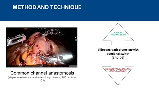 Shaping the Technique: Robotic Biliopancreatic Diversion with Duodenal Switch,