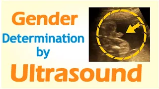 Gender Determination by Ultrasound