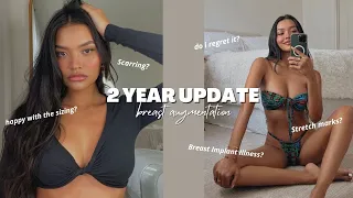 2 Years Later Follow Up on My Breast Aug! Answering Your Questions! | NICOLE ELISE