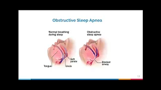 Sleep Medicine Dr  Jay Guevarra