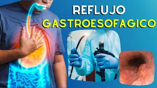 🔥 ERGE Causas, Diagnostico y Tratamiento de la Enfermedad por Reflujo Gastroesofágico | Podcast