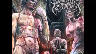 Human Chunks - Intestinal Entanglement