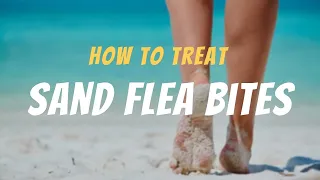 Immediate Action: How to Treat Sand Flea Bites Like a Pro