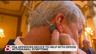 FDA approves device to help with opioid withdrawal symptoms