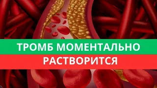 Эти 6 продуктов моментально растворят ТРОМБЫ в сосудах