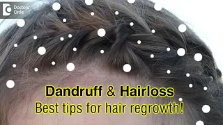 Is hair loss due to dandruff reversible? if yes, how? - Dr. Nischal K