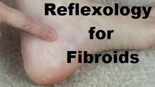 Reflexology for Fibroids - Massage Monday #274