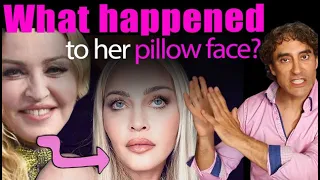 What Happened to Madonna's Face || Madonna's Pillow Face Explained