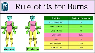 Rule of Nines for Burns MADE EASY: Adult & Baby Calculation [EMT, Nursing]