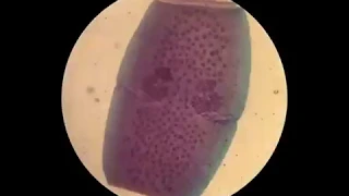 What it looks like under the microscope
