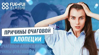 Волосы выпадают округлыми очагами. Что делать?