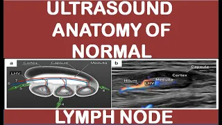 Ultrasound anatomy of normal lymph node