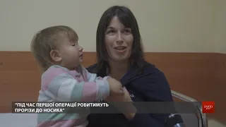 У Львові відомий німецький пластичний хірург безкоштовно оперує дітей